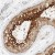 Immunohistochemistry-Paraffin: AARSD1 Antibody [NBP1-81143] - Immunohistochemical staining of human testis shows strong cytoplasmic positivity in cells of the seminiferus ducts.